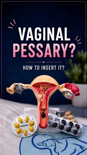 Vaginal Pessary? Here’s How to Insert It