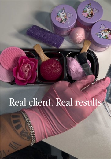 Toe Transformation Journey: From Hiding to Confident