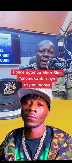 Ugandan Police Investigates Alien Skin Case