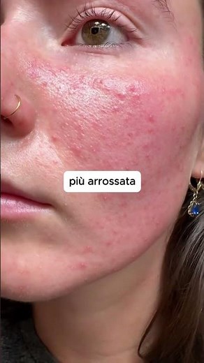 Ecco perché hai prurito dopo la doccia.