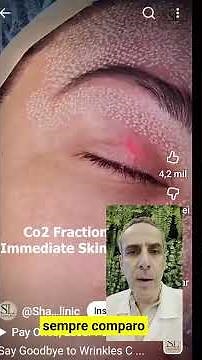 ⚡️ The Secret of CO2 Laser: It's not meant to BURN, it's meant to RENEW! 💎✨