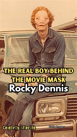 Rocky Dennis. Before the world knew him as the inspiration for the heart-wrenching film Mask, Rocky Dennis was a boy who spent his life proving every medical expert wrong with a smile and a biting sense of humor. What’s your favorite scene or lesson from his story? Let me know in the comments below! If you were moved by Rocky’s incredible journey of courage, Like and Subscribe for more deep dives into the true stories behind Hollywood’s greatest legends! #truestory #inspirationalstory | Celebrit
