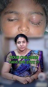 Recurrent Styes (கண்கட்டி) in Children: Causes, Stages & Permanent Treatment Explained