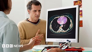 NHS uses AI scan to detect hidden heart disease