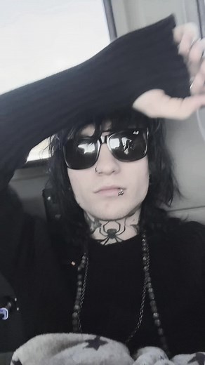 Dealing with Chin Pimples: Tips and Tricks