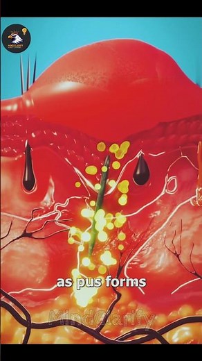 How Splinters Get Unstuck 😲 #facts, #amazingfacts, #shorts,#MindClarify