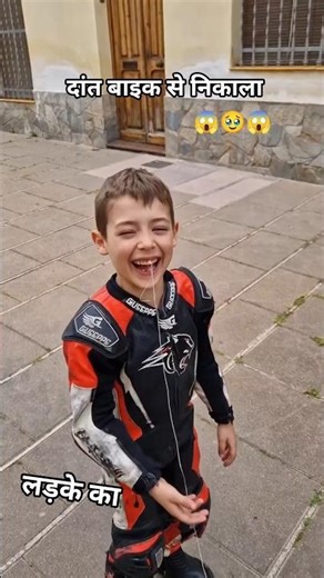 The boy refused to get his rotten tooth removed #ytshorts #trending