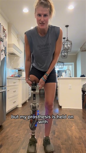 Gini Thomas on Instagram: "In case you’ve missed my previous explanations, here ya go! I have the @integrumusa OPRA™️ implant system, which is the ONLY FDA approved implant in the US for transfemoral use. OPRA stands for Osseoanchored Prostheses for the Rehabilitation of Amputees. This implant is also the only one on the market that allows for the skin to attach/heal to the end of the bone—that’s the Bonded Matrix™️. This has been a game changer for me. Absolutely no regrets. The fancy cover on