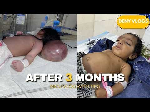 Another Operation Planned: After 3 Months Baby Came Back Again With Hydrocephalus