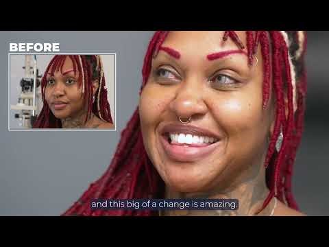 Eye Color Change at KERATO Under 30 Minutes?? (Review)