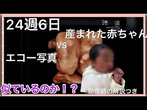 【4Dエコーあり】【妊娠24週】助産師がエコーを解説してみた。エコーと産まれた赤ちゃんは本当に似ているのか？妊娠23週　妊娠25週　妊娠26週　妊婦健診7ヶ月