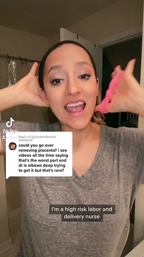 Understanding Placenta Removal During Labor and Delivery