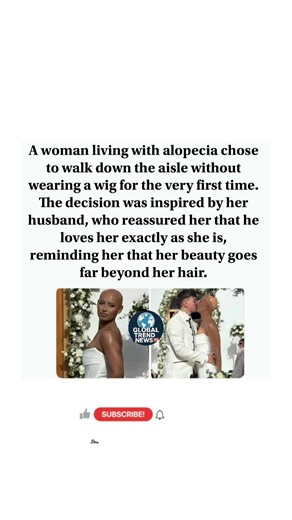Woman With Alopecia Disease Marries Without a Wig After Husband's Heartfelt Support ❤️ #Love