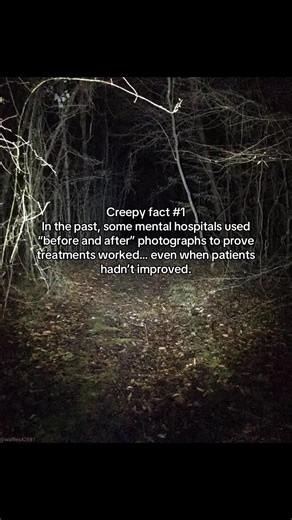Ponki out ✌️ #fyp #horrortok #creepyfacts | lobotomy photos before and after