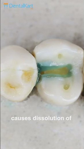 What is & how to use dental etchant gel! #dental #waldent #Bestetch #dentalkart