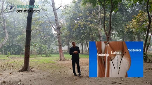 Dr. Ashwani Maichand on Instagram: "Difference between MIS and DAA Hip Replacement #hipreplacement"