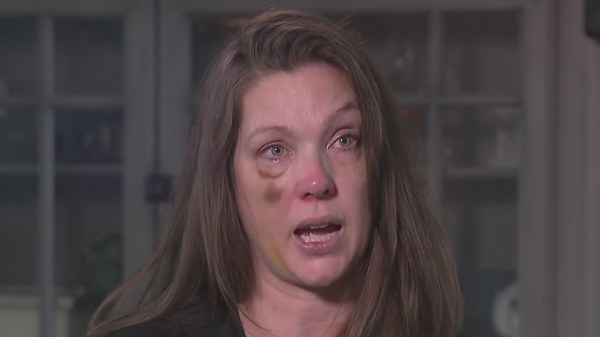 Cincinnati beating victim says she thought she was dead after attack