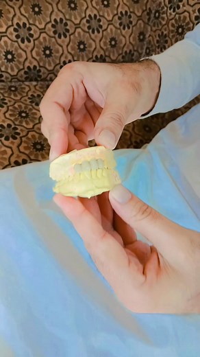 38 reactions · 4 comments | Beauty of PFM Dentist Hazrat Ullah safi Stomatologist #PFM #everyonehighlightsfollowerseveryonehighlightsfollowerseveryone | DentistHazrat Safi | Facebook