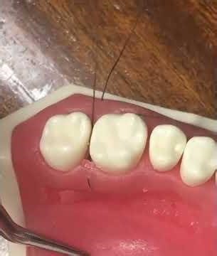 master suturing!suturing made easy # simple suture#sutures in surgery