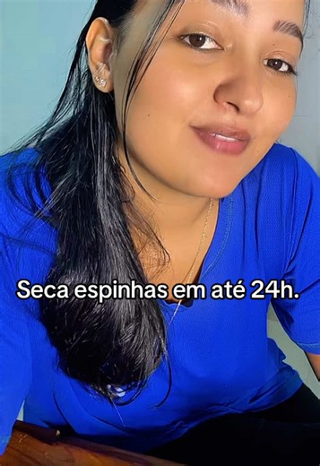 Sérum Antiacne Sallve - 2% de Ácido Salicílico, Niacinamida e Melaleuca - Trata e previne acne, Seca espinhas em 24h, Controla oleosidade da pele e Minimiza os poros. #acne #espinha #oleosidade #compreinotiktokshop