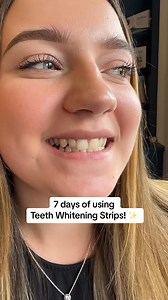Hvítara bros á nokkrum dögum ! 😁 Whites Premium Teeth Whitening Strips breyta brosinu þínu til hins betra án kuls, óþæginda og fyrirhafnar. Strimlarnir virka á öruggan hátt til að endurheimta náttúrulegan hvítleika tannanna þinna og gefa þér bjartara, ferskara og sjálfsöruggara bros. Léttir, þægilegir og einfaldir í notkun. Þú setur þá á, bíður í 30 mínútur og sérð muninn. 😁 Sýnilegur árangur á nokkrum dögum. 😁 Ekkert kul bara hreint og hvítara bros. 😁 30 mínútur á dag..14 dagar í nýtt sjálf