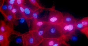 Dye shortage impacting CT scans