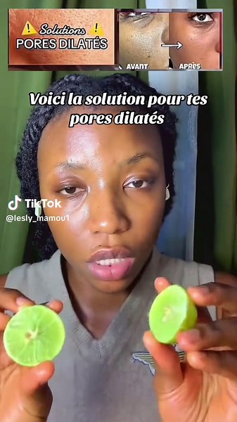 La solution pour remédier au pores dilaté #teintpropre🥰🥰❤️❤️❤️ #poredilate #ressererlespores #citron
