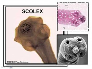 Phylum Platyhelminthes