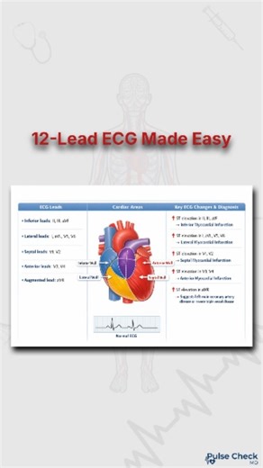 Pulsecheck MD on Instagram: "🫀 12-Lead ECG Made Simple | Lead-Wise Cardiac Areas Explained 📊 Understanding a 12-Lead ECG isn’t hard when you know which lead looks at which part of the heart ❤️ 👉 From Inferior, Lateral, Anterior, Septal to Right Ventricular views 👉 Learn what to observe: ST elevation, T-wave inversion, Q waves, R progression 👉 Identify conditions like MI, Ischemia, LVH, AV blocks & Arrhythmias 📌 Perfect for: ✔ Medical students ✔ Nursing students ✔ ECG beginners ✔ Emergency 