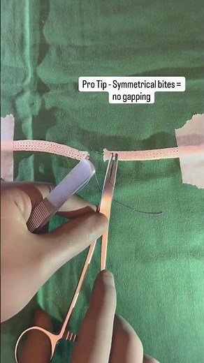 Modified Kessler Tendon Repair | Flexor Tendon Suture Technique #suturing #surgery #shorts #surgeon
