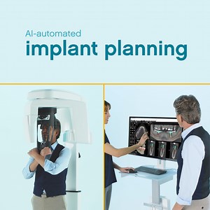 Speed up your implant planning workflow with new AI-powered implant planning. Now, you can automate mandibular nerve mapping, virtual crown design and virtual implant placement for a faster and smoother workflow. See how AI can speed up your workflow. https://bit.ly/42EQuZG #CBCT #3DImaging #AIpowered #CarestreamDental | Carestream Dental