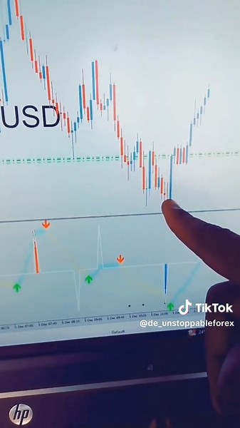 Essential Forex Tips for Successful Trading