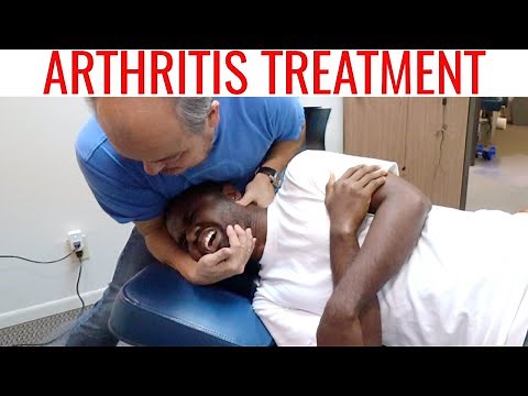 DISH (Diffuse Idiopathic Skeletal Hyperostosis) treatment by Chiropractor - Part 2/2