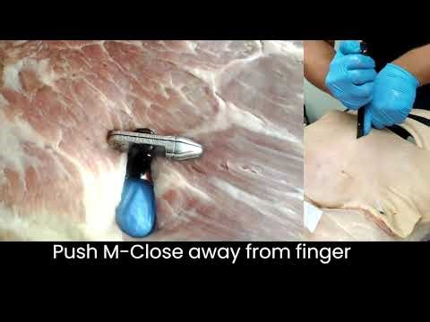 Closing extraction site with M-Close (Short Video)