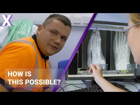 Tree Surgeon Breaks Same Foot Twice In Bizarre ER