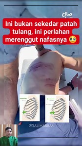 2.2M views · 5.1K reactions | Kondisi ini disebut dengan Paradoxical...