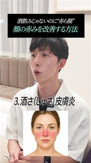 お酒を一滴も飲んでいないのに、いつも顔が赤く見えませんか？🍷実はその“赤ら顔”、肌トラブルや血管の変化が関係している可能性があります。皮膚科専門医が原因とケア方法を詳しく解説します❣ #ゼロ皮膚科医院