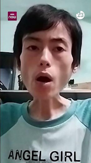 Cô gái Hưng Yên nhịn ăn để giảm cân hiện "da bọc xương": "Tôi hối hận vì coi thường sức khỏe"