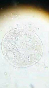 Stool sample 😲😲❤️🔬 | Lab life