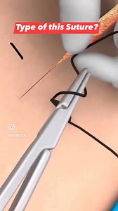 375K views · 2.6K reactions | What is the Type of this Suture? | Medical Talks | Facebook