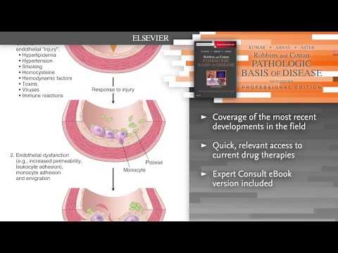 "Robbins and Cotran Pathologic Basis of Disease, Professional Edition", 9th Edition