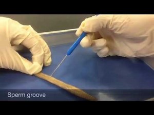 Annelid Dissection - Invertebrate Anatomy
