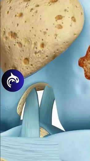 Chondral Repair of the Knee // See How It Works // 3D Animation