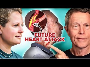 CIMT Expert: This Test Predicts 98% of Heart Attacks