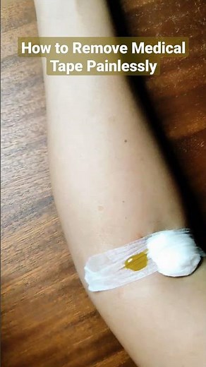 How to remove medical tape painlessly