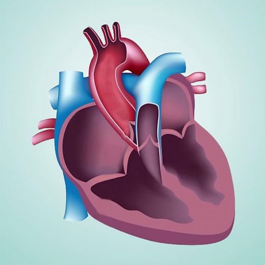 Válvula Aórtica Bicúspide