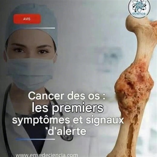 Symptômes du cancer des os : signes d'alerte à ne pas ignorer. | Codes De Couples
