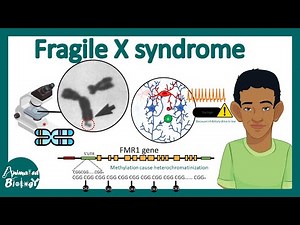Fragile X syndrome | Genetics, cell biology and pathology of Fragile X syndrome | USMLE Step 1