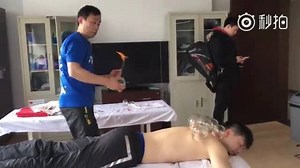 17 reactions | Have you ever tried out cupping therapy? #MaLong | Malongfamily Fans Club | Facebook