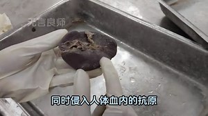 这个器官的尺寸大约有12cm，他也是人体中最大的淋巴器官
